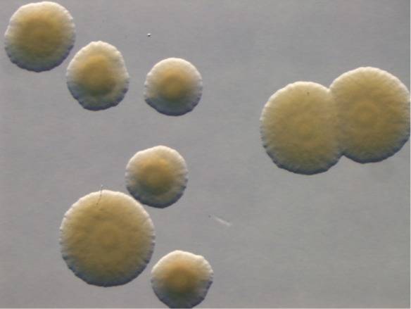 Colonie de Xanthomonas arboricola vue à la loupe binoculaire