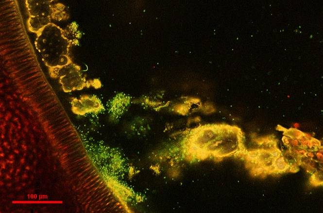 Coupe transversale d'une graine de haricot contaminée par une souche de Xanthomonas marquée à la GFP
